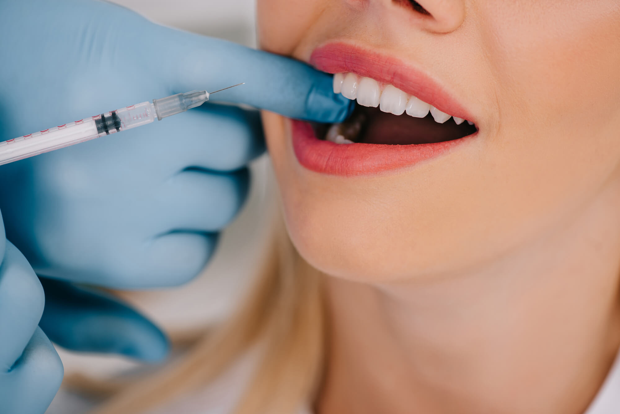 Closeup of a patient getting General Anesthesia Plano