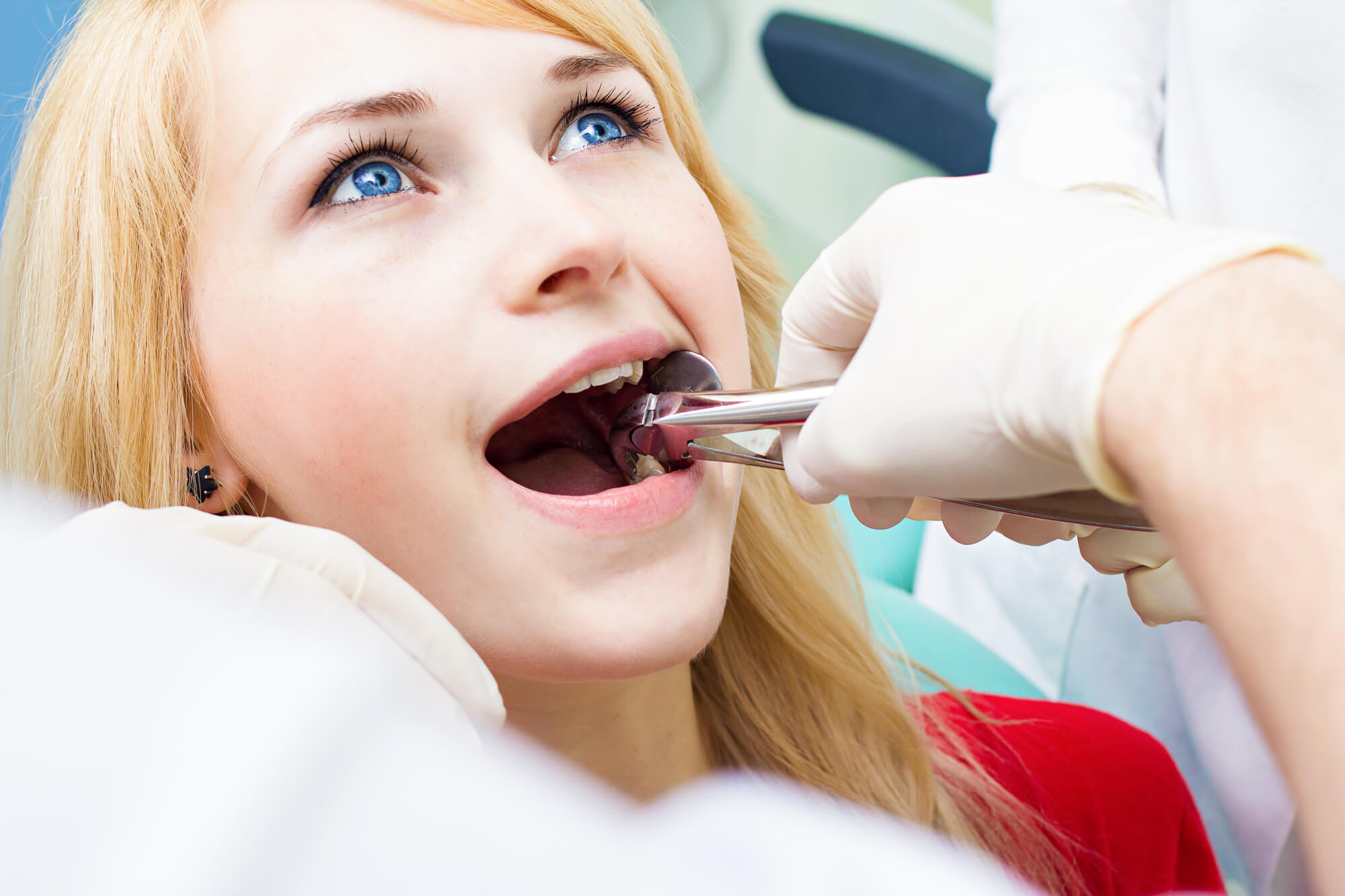 female patient getting Wisdom Teeth Removal 76210