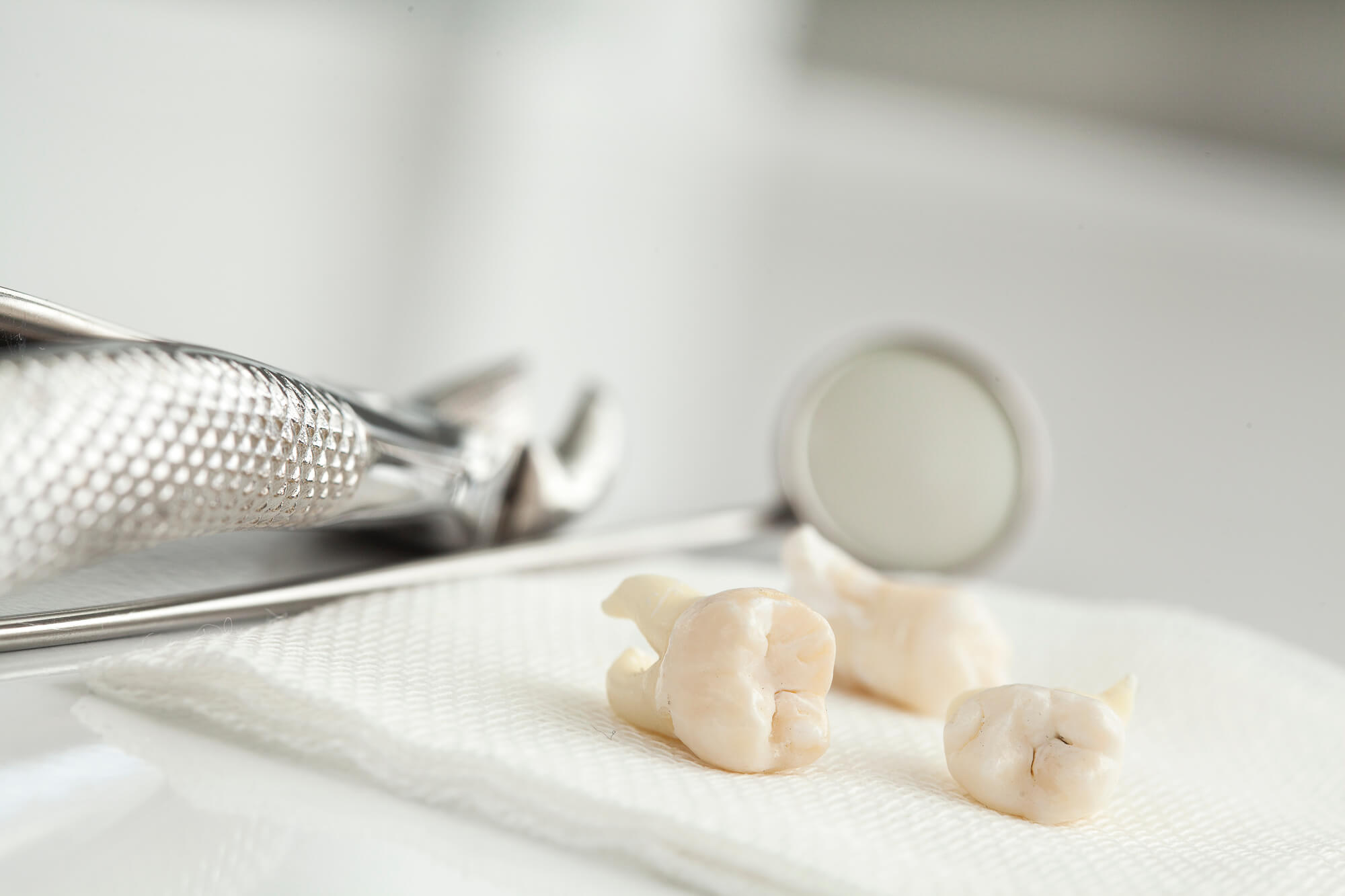 Closeup of a Tooth Removal 76210