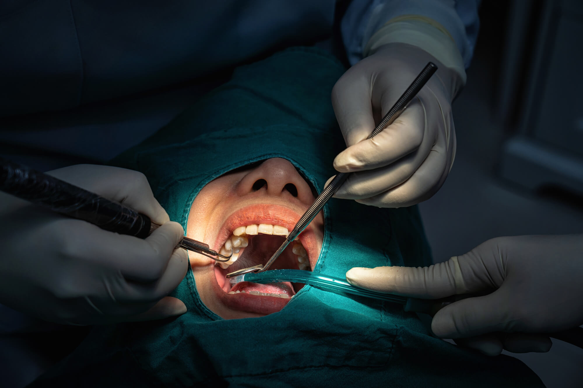 dentist performing Dental Surgery 75075