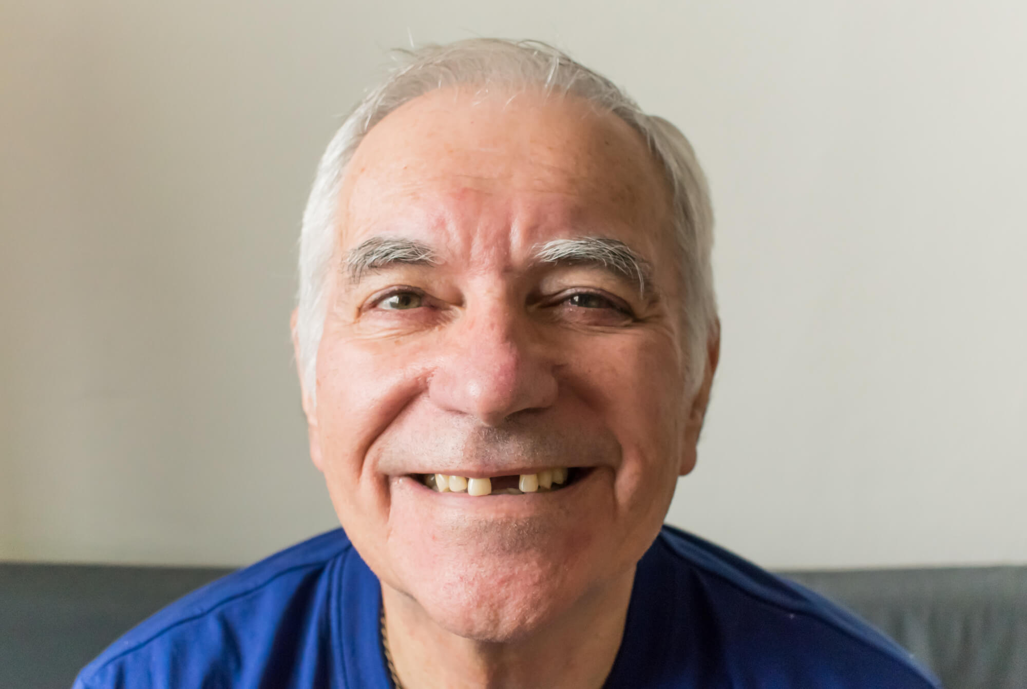 Man needs dental implants in Denton