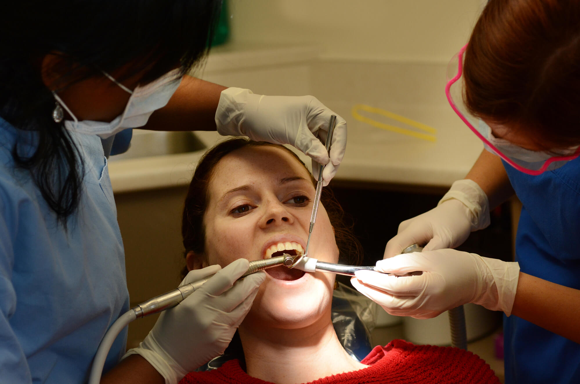 dentists extract wisdom teeth in Plano
