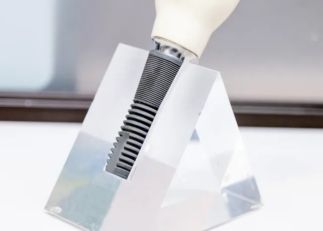 Dental Implants Dental Implants