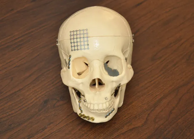 Facial Trauma Treatment Facial Trauma Treatment