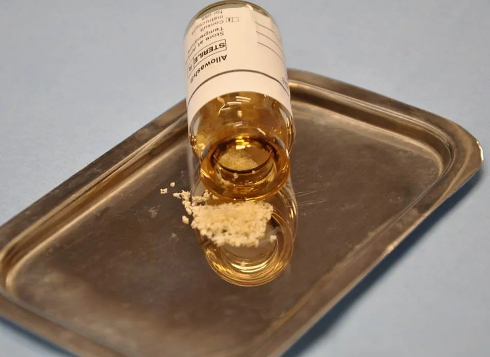 Bone Grafting Image Bone Grafting Image